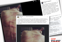 Yalan: Silahlı Kuvvetlerden bir askerin sırtına “Nazi sembolü” oyulmuştu