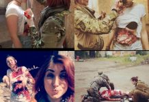 Фейк второй свежести. Посольство России в Лондоне опубликовало ложное обвинение Украины в создании фальшивых фото раненых мирных жителей